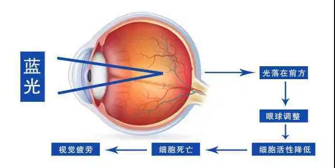 宅家1个月近视飙升200度？这个护眼方法别忽略！