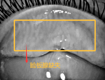 一组数据揭秘残酷真相:20岁年轻人竟输给60岁新老人